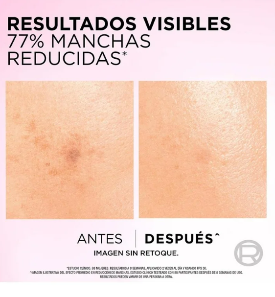 Sérum facial Loreal Paris Glycolic Bright antimanchas ácido glicólico, niacinamida 30 ml