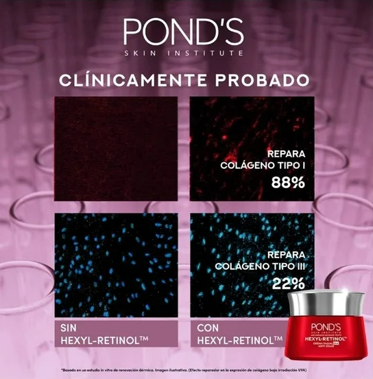 Crema facial Pond's Age Miracle Ultimate Youth de día Hexyl Retinol antiedad 50 g